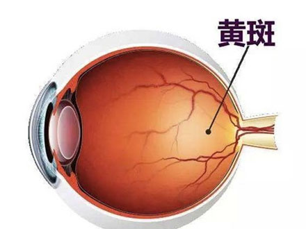 眼底黄斑水肿的原因是什么(图1)